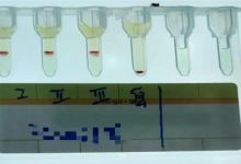 比“熊猫血”还稀有!云南检出一例全球罕见的小p血型-紫竹林-程序员中文网