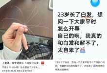 白头发别急着拔!重新变黑发的方法找到了-紫竹林-程序员中文网