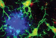 重磅：科学家找到阿尔茨海默病的“内置刹车系统”-紫竹林-程序员中文网