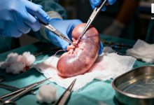 异种移植迎突破：美国启动人体移植基因编辑猪肾规模化临床试验-紫竹林-程序员中文网