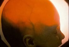 大脑缺失 小脑只有蚕豆大小!美国“无脑畸形”女子创造奇迹-紫竹林-程序员中文网