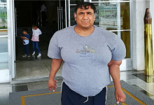 深潜后上升太快 秘鲁潜水员身体肿成大力水手：太痛苦！-紫竹林-程序员中文网