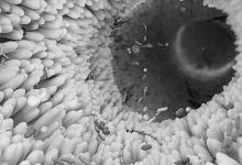 健康的肠道菌群到底长啥样？-紫竹林-程序员中文网