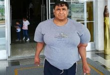 男子潜水氧气管被切断 全身肿胀如大肌霸！11年治疗无果-紫竹林-程序员中文网