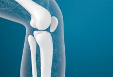 女孩确诊骨癌:自己签字6次手术截肢-紫竹林-程序员中文网