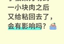 手指被刀切掉一块肉 “粘回去”有用吗-紫竹林-程序员中文网