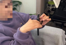 高位截瘫女子植入脑机1年后重新控制双手:能流畅刷手机了-紫竹林-程序员中文网