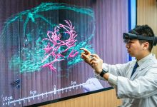 两会新华鲜报丨“接”入未来！脑机接口首入政府工作报告-紫竹林-程序员中文网