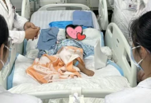 3岁女童家中被眼镜王蛇咬伤：全身瘫痪呼吸衰竭 假死3天奇迹生还-紫竹林-程序员中文网