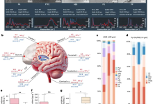 北京天坛医院、协和医院等首次证实人脑中存在“微 / 纳米塑料”-紫竹林-程序员中文网