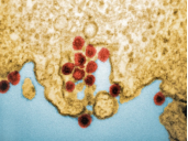 顶尖大学实验室病毒样本失窃，嫌疑人系该校助理教授-紫竹林-程序员中文网