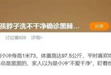 脖子总是黑黑的洗不干净？别大意 这可能是身体在求救-紫竹林-程序员中文网
