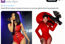 Cardi B整形前后对比曝光 曾花800美元黑市注射-紫竹林-程序员中文网