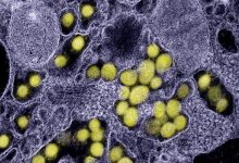我国科学家合成了一种细菌 能够精准消灭肿瘤!-紫竹林-程序员中文网